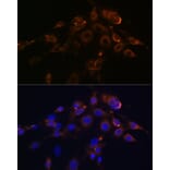 Immunofluorescence - Anti-DR5 Antibody [ARC0406] (A305494) - Antibodies.com