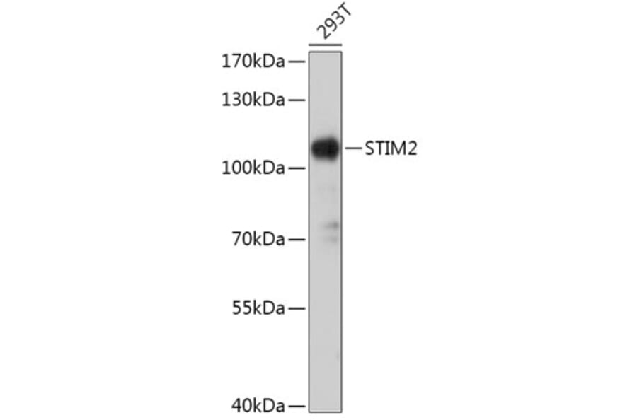 Western Blot - Anti-STIM2 Antibody (A305495) - Antibodies.com