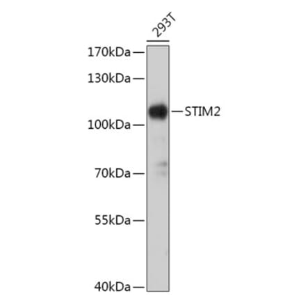 Western Blot - Anti-STIM2 Antibody (A305495) - Antibodies.com
