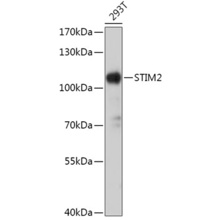 Western Blot - Anti-STIM2 Antibody (A305495) - Antibodies.com