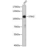 Western Blot - Anti-STIM2 Antibody (A305495) - Antibodies.com