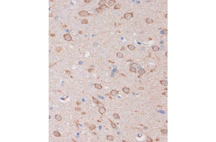 Immunohistochemistry - Anti-STIM2 Antibody (A305495) - Antibodies.com
