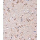 Immunohistochemistry - Anti-STIM2 Antibody (A305495) - Antibodies.com