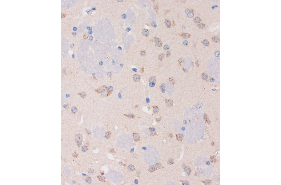 Immunohistochemistry - Anti-STIM2 Antibody (A305495) - Antibodies.com