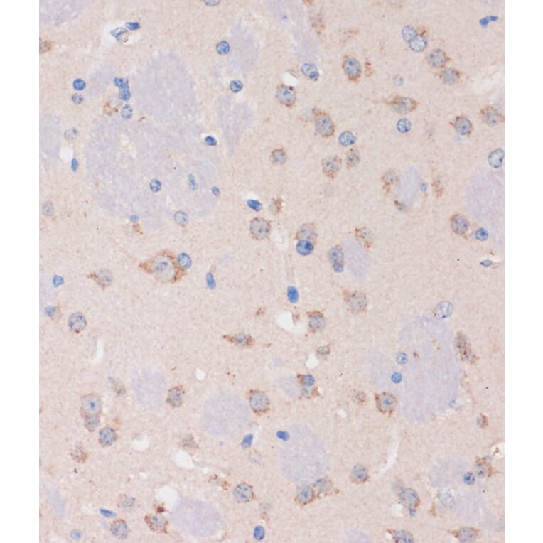 Immunohistochemistry - Anti-STIM2 Antibody (A305495) - Antibodies.com