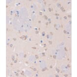 Immunohistochemistry - Anti-STIM2 Antibody (A305495) - Antibodies.com