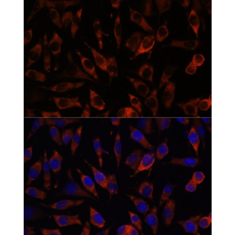 Immunofluorescence - Anti-STIM2 Antibody (A305495) - Antibodies.com