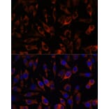 Immunofluorescence - Anti-STIM2 Antibody (A305495) - Antibodies.com