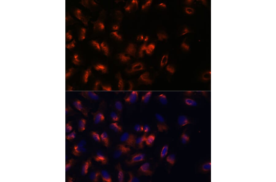 Immunofluorescence - Anti-STIM2 Antibody (A305495) - Antibodies.com