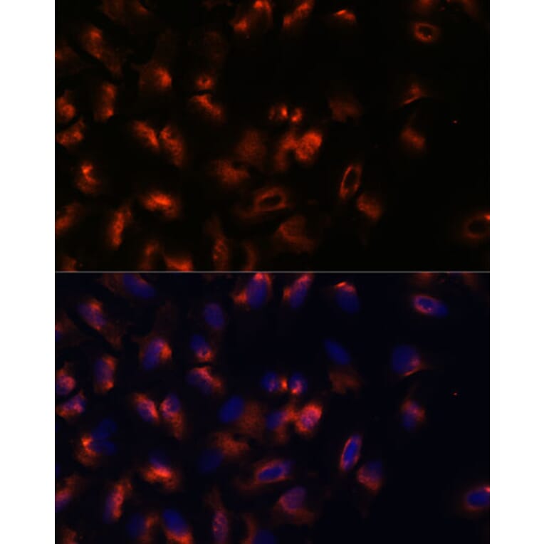 Immunofluorescence - Anti-STIM2 Antibody (A305495) - Antibodies.com