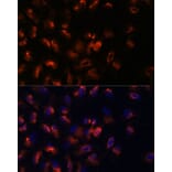 Immunofluorescence - Anti-STIM2 Antibody (A305495) - Antibodies.com