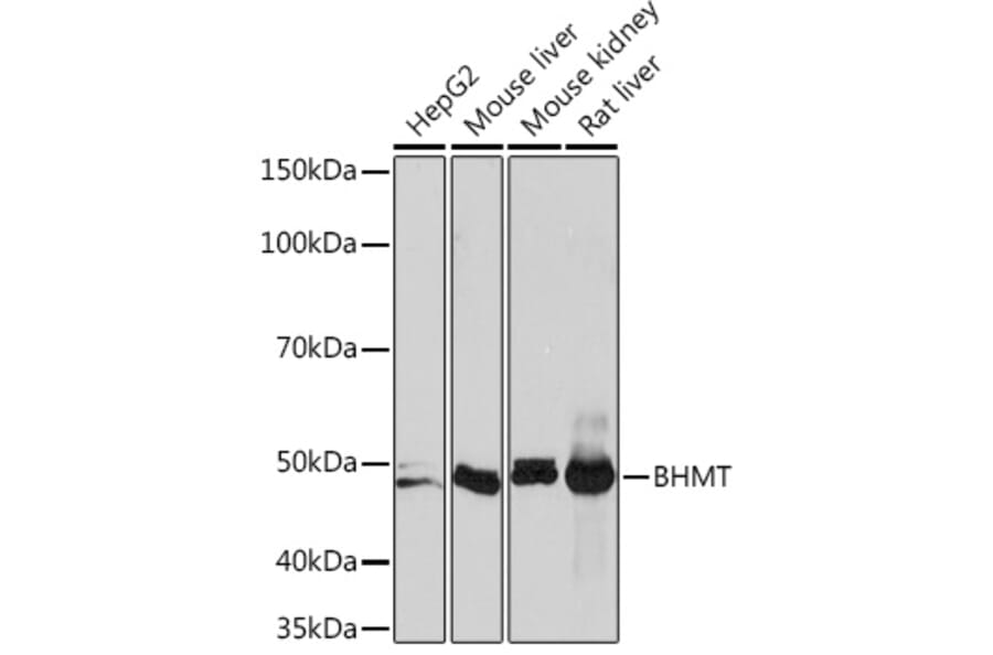Western Blot - Anti-BHMT Antibody [ARC1249] (A305496) - Antibodies.com