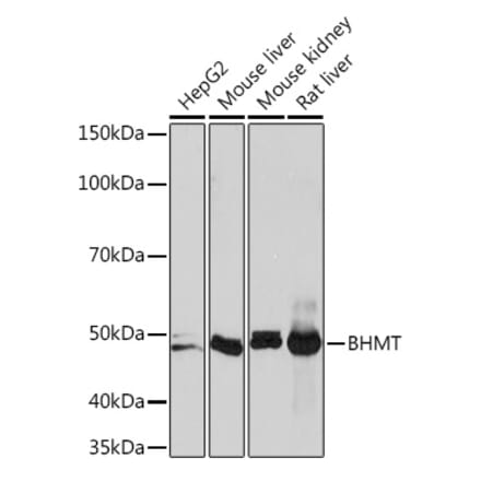 Western Blot - Anti-BHMT Antibody [ARC1249] (A305496) - Antibodies.com