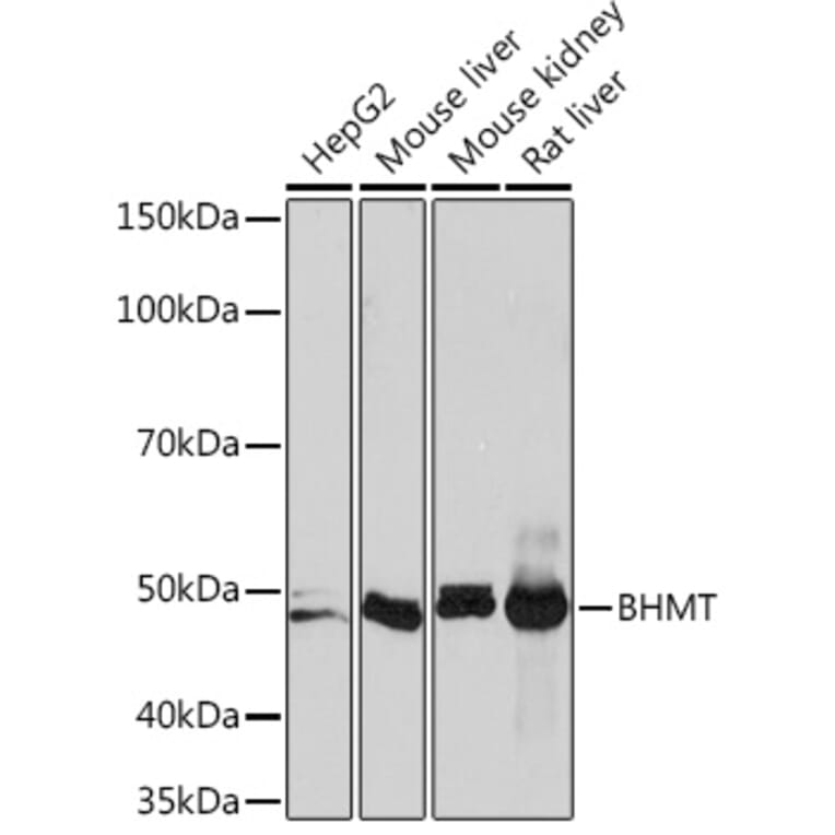 Western Blot - Anti-BHMT Antibody [ARC1249] (A305496) - Antibodies.com