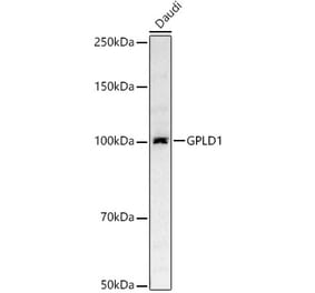 Western Blot - Anti-GPI-PLD Antibody (A305497) - Antibodies.com