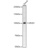 Western Blot - Anti-GPI-PLD Antibody (A305497) - Antibodies.com