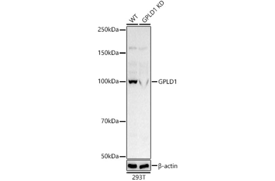 Western Blot - Anti-GPI-PLD Antibody (A305497) - Antibodies.com