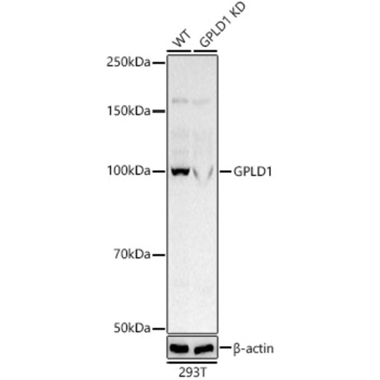 Western Blot - Anti-GPI-PLD Antibody (A305497) - Antibodies.com