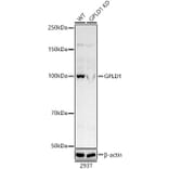 Western Blot - Anti-GPI-PLD Antibody (A305497) - Antibodies.com