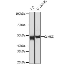 Western Blot - Anti-CaMKII beta Antibody [ARC1813] (A305498) - Antibodies.com