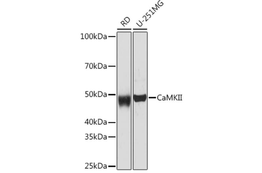 Western Blot - Anti-CaMKII beta Antibody [ARC1813] (A305498) - Antibodies.com
