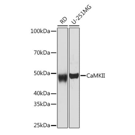 Western Blot - Anti-CaMKII beta Antibody [ARC1813] (A305498) - Antibodies.com