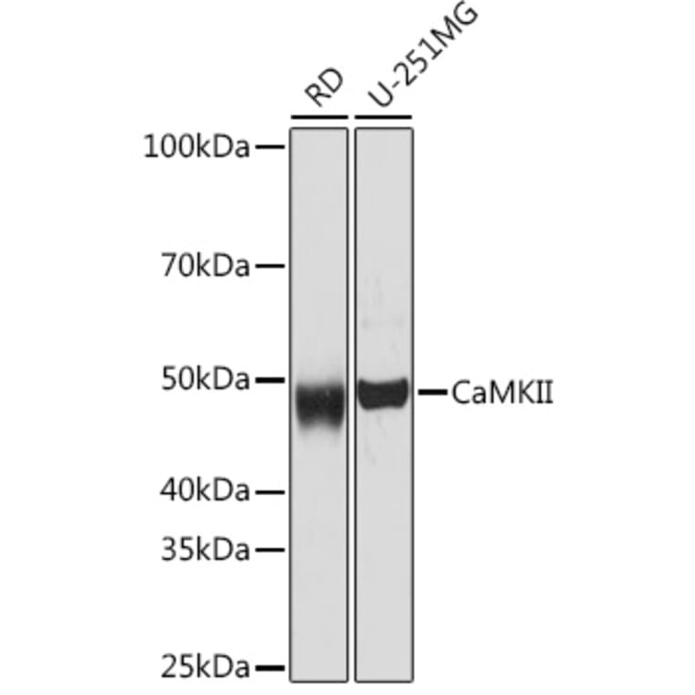 Western Blot - Anti-CaMKII beta Antibody [ARC1813] (A305498) - Antibodies.com