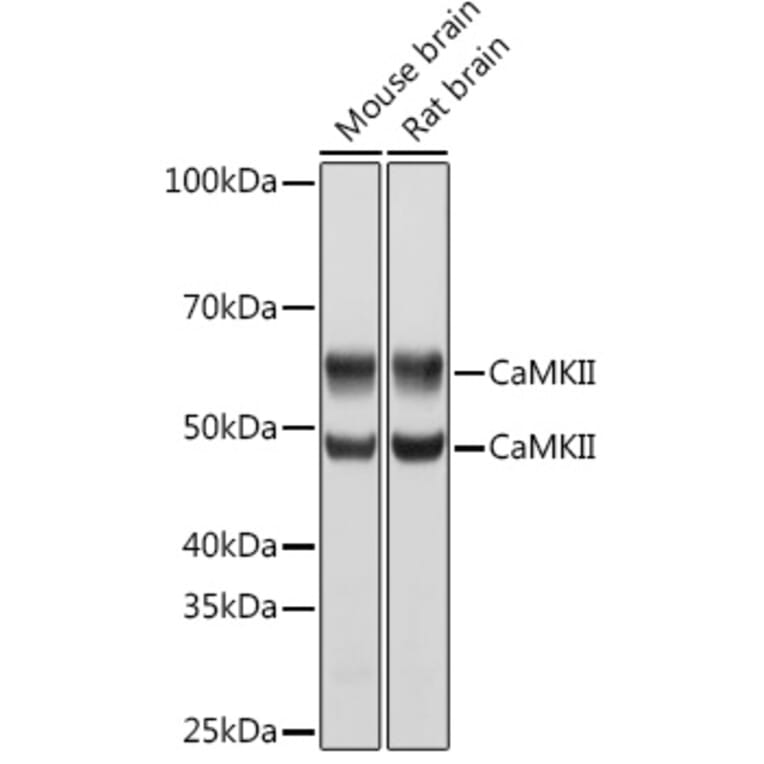 Western Blot - Anti-CaMKII beta Antibody [ARC1813] (A305498) - Antibodies.com