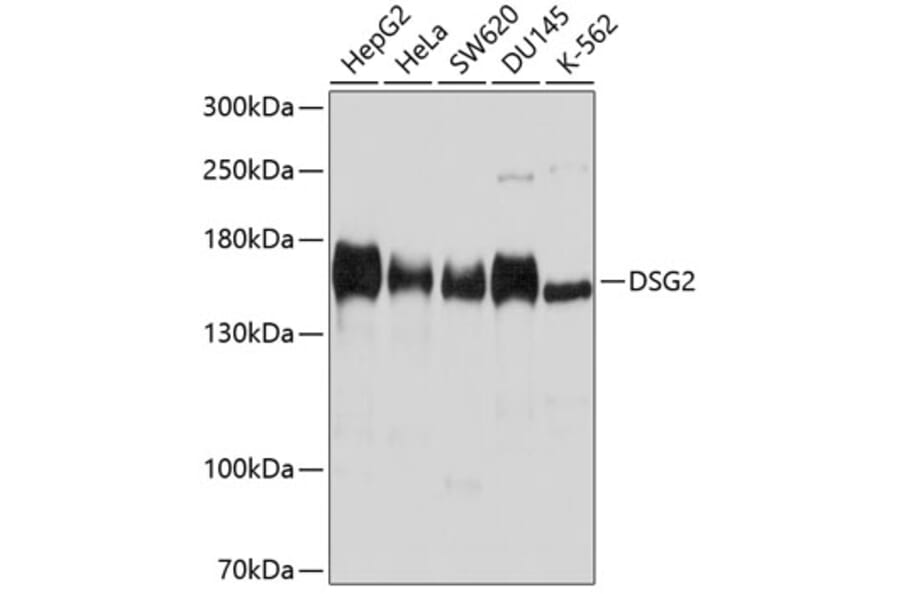 Western Blot - Anti-Desmoglein 2/DSG2 Antibody (A305499) - Antibodies.com
