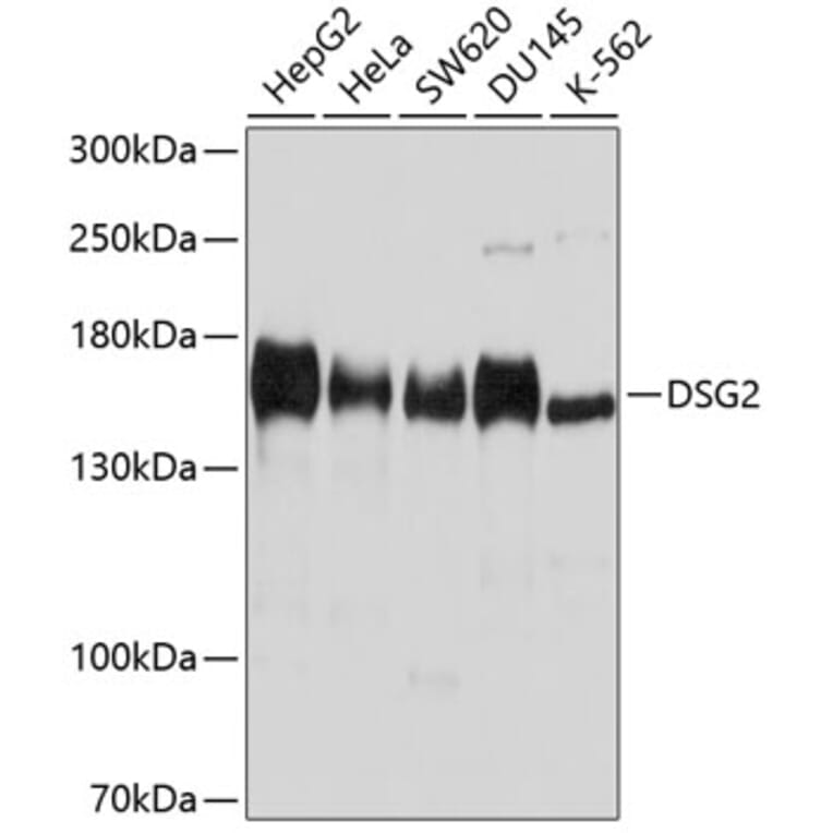 Western Blot - Anti-Desmoglein 2/DSG2 Antibody (A305499) - Antibodies.com