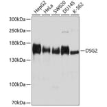 Western Blot - Anti-Desmoglein 2/DSG2 Antibody (A305499) - Antibodies.com