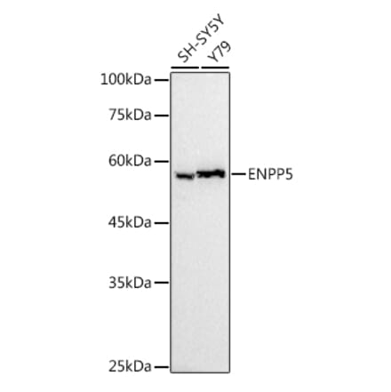 Western Blot - Anti-ENPP5 Antibody [ARC2780] (A305501) - Antibodies.com