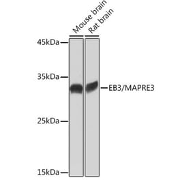 Western Blot - Anti-EB3 Antibody [ARC2305] (A305503) - Antibodies.com