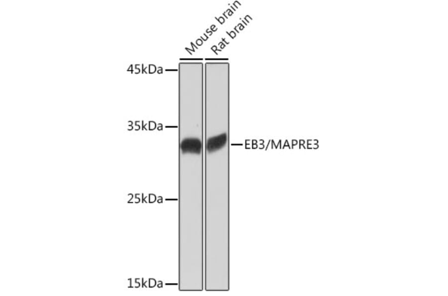 Western Blot - Anti-EB3 Antibody [ARC2305] (A305503) - Antibodies.com