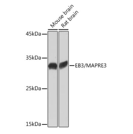 Western Blot - Anti-EB3 Antibody [ARC2305] (A305503) - Antibodies.com