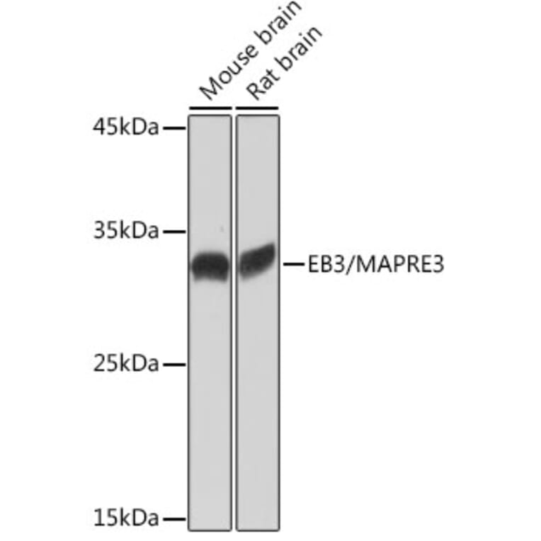 Western Blot - Anti-EB3 Antibody [ARC2305] (A305503) - Antibodies.com