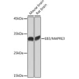 Western Blot - Anti-EB3 Antibody [ARC2305] (A305503) - Antibodies.com