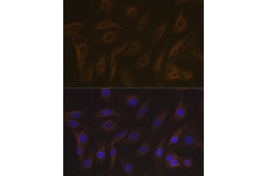 Immunofluorescence - Anti-EB3 Antibody [ARC2305] (A305503) - Antibodies.com