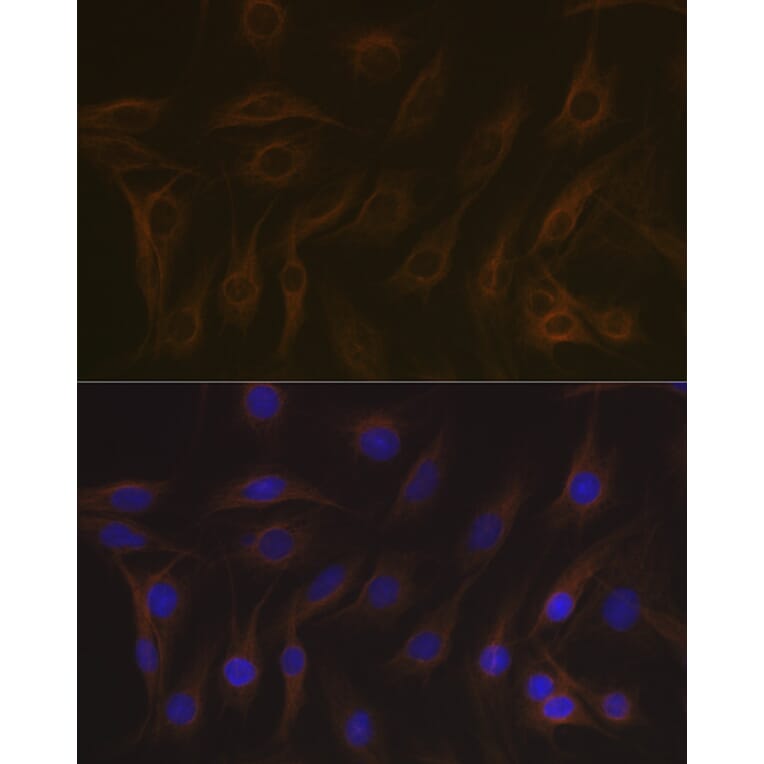 Immunofluorescence - Anti-EB3 Antibody [ARC2305] (A305503) - Antibodies.com