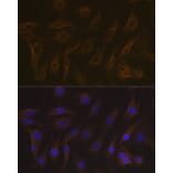 Immunofluorescence - Anti-EB3 Antibody [ARC2305] (A305503) - Antibodies.com