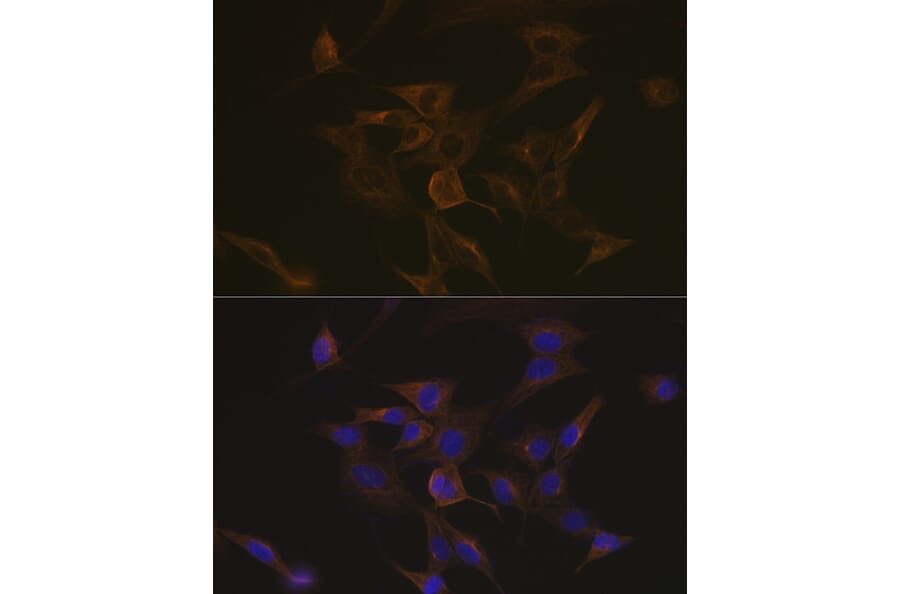 Immunofluorescence - Anti-EB3 Antibody [ARC2305] (A305503) - Antibodies.com