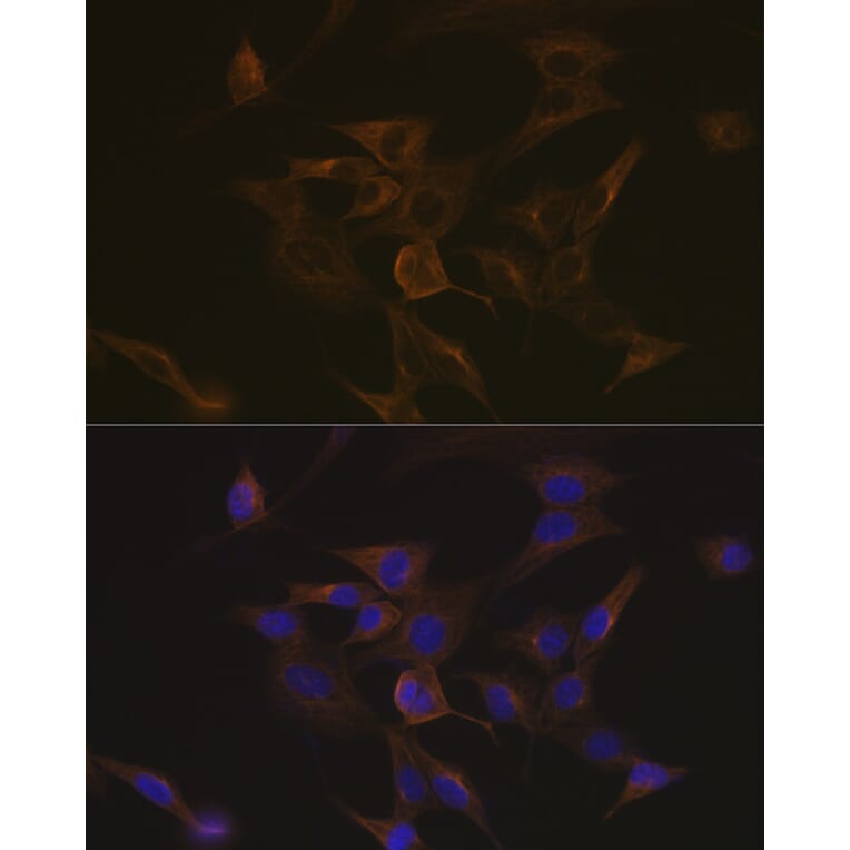 Immunofluorescence - Anti-EB3 Antibody [ARC2305] (A305503) - Antibodies.com