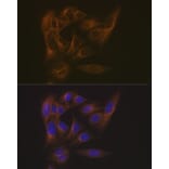 Immunofluorescence - Anti-EB3 Antibody [ARC2305] (A305503) - Antibodies.com