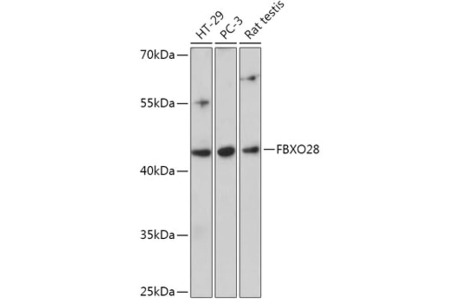 Western Blot - Anti-FBXO28 Antibody (A305504) - Antibodies.com