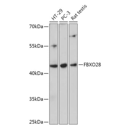 Western Blot - Anti-FBXO28 Antibody (A305504) - Antibodies.com