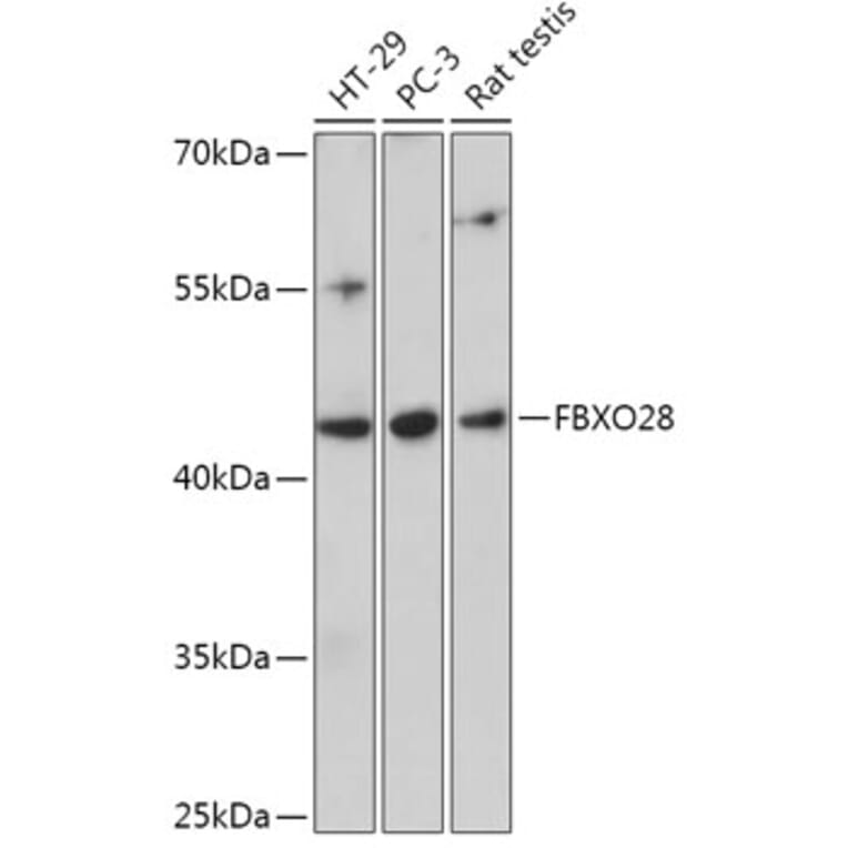 Western Blot - Anti-FBXO28 Antibody (A305504) - Antibodies.com
