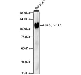 Western Blot - Anti-Ionotropic Glutamate receptor 2 Antibody [ARC53741] (A305506) - Antibodies.com