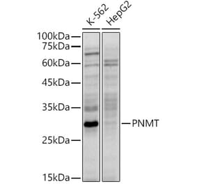 Western Blot - Anti-PNMT Antibody [ARC2786] (A305507) - Antibodies.com
