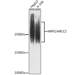 Western Blot - Anti-MRP2 Antibody [ARC1619] (A305508) - Antibodies.com