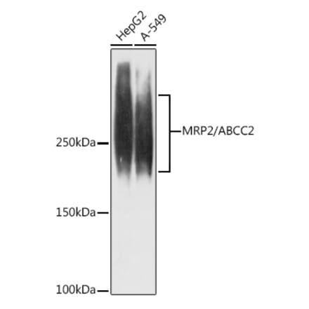 Western Blot - Anti-MRP2 Antibody [ARC1619] (A305508) - Antibodies.com